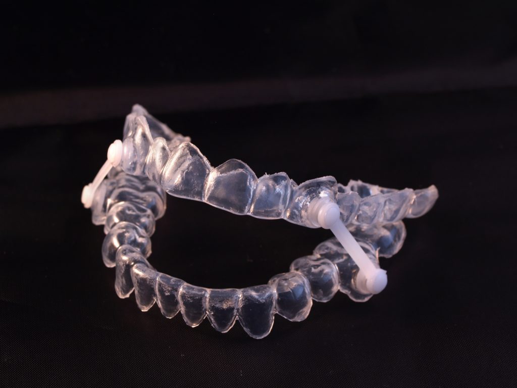 sleep-apnea-custom-oral-appliance-peak-dental